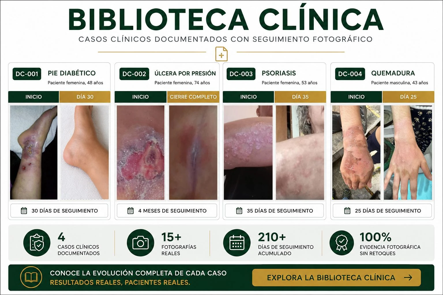 Biblioteca clínica con casos documentados de pie diabético, úlcera por presión, psoriasis y quemaduras con seguimiento fotográfico.
